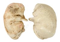 Lot 181 - Ø TWO EARLY 20TH CENTURY SPERM WHALE EAR...